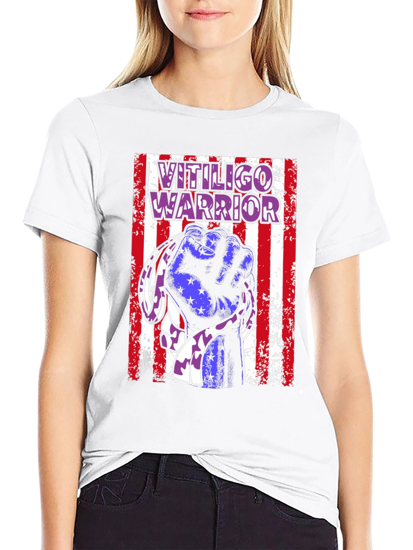Vitiligo Warrior T-Shirt - Show Your Support!