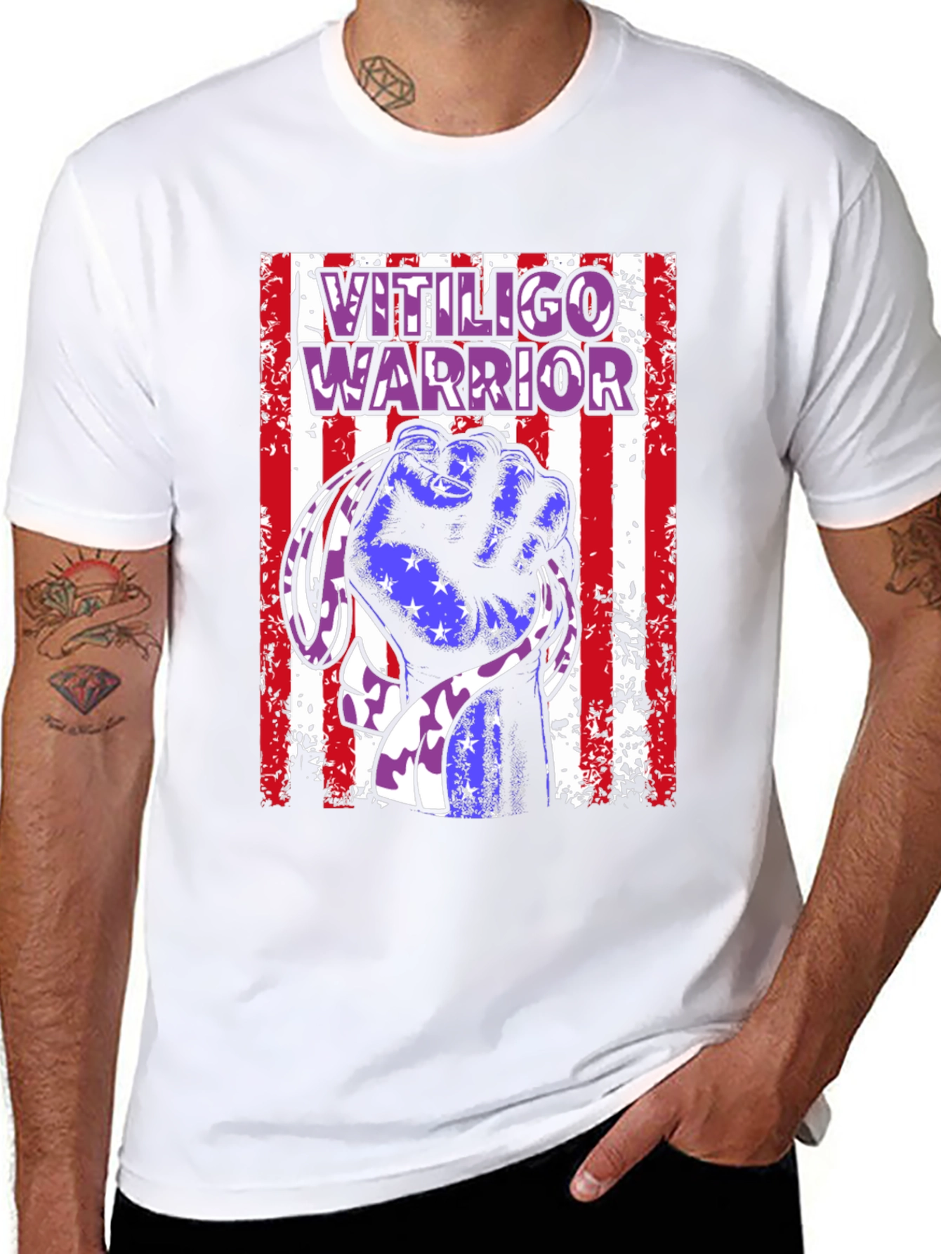 Vitiligo Warrior T-Shirt - Show Your Support!